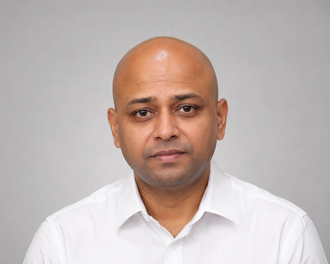 Hair loss before consultation for non surgical hair replacement